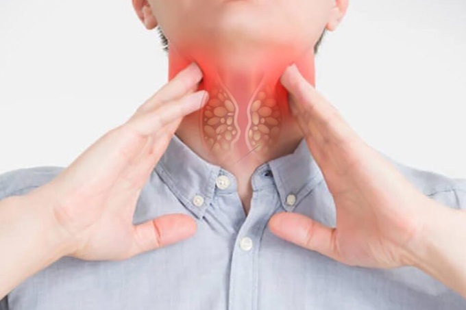 Ung thư thực quản giai đoạn 4: Dấu hiệu và phương pháp điều trị