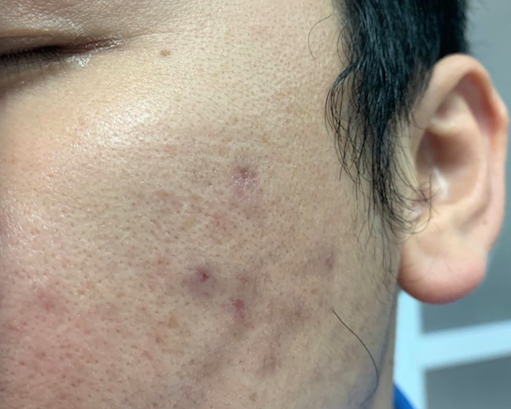 Tại sao da mặt nhiều đàn ông đẹp hơn phụ nữ?
