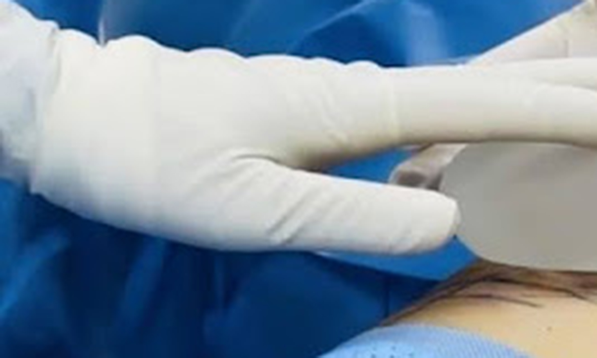 Chuyên gia thẩm mỹ tư vấn chọn size túi nâng ngực phù hợp cho khách hàng