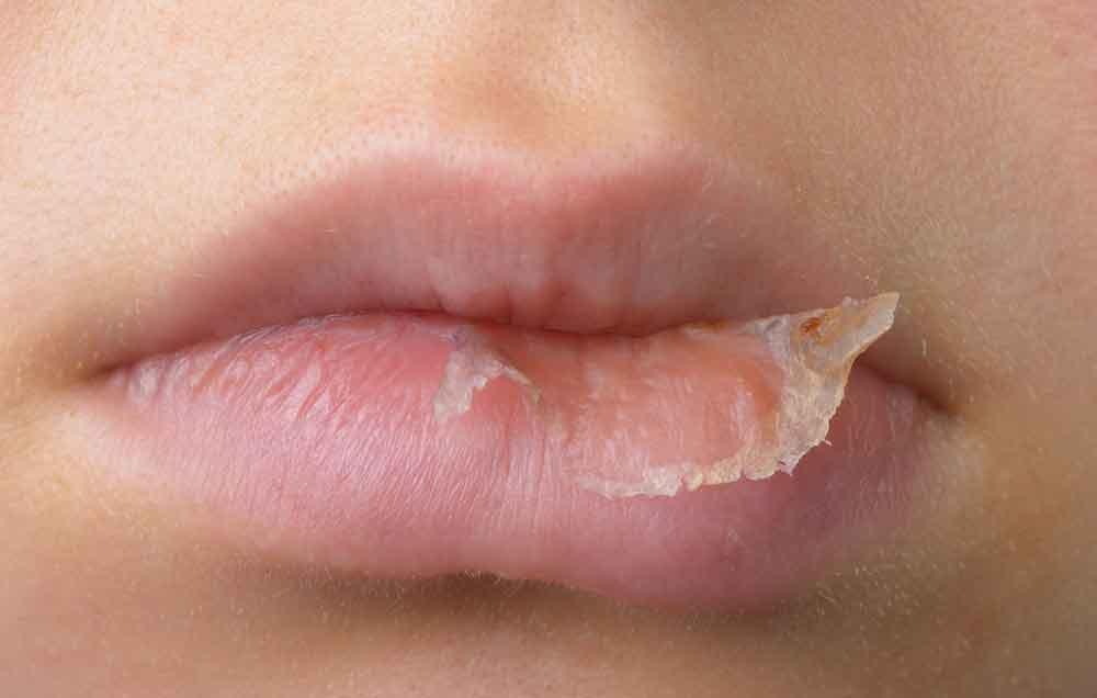 Mẹo tô son cho môi khô nẻ